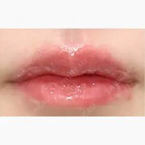 ルラ美容クリニック 仙台院 / ルラスキンクリニック 仙台院口コミ