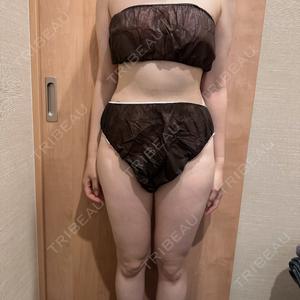 AVAN TOKYO 銀座脂肪吸引 クリニック口コミ