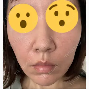 Natural Skin Clinic 笹塚院口コミ