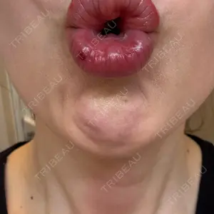 神戸スイミー皮膚科美容外科口コミ