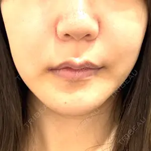 ノエル銀座クリニック口コミ