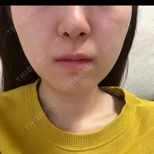 ルラ美容クリニック 大阪本院口コミ