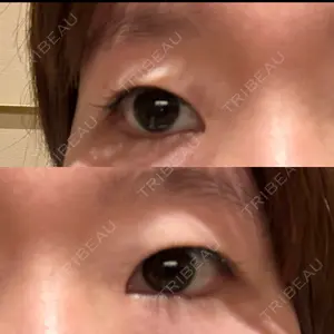 聖心美容クリニック 銀座院口コミ