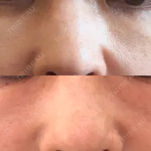 Natural Skin Clinic 自由ヶ丘院口コミ