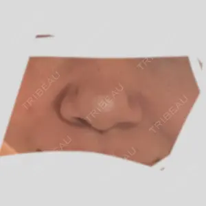 ルラ美容クリニック 大阪本院口コミ