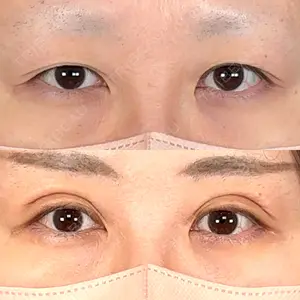 アリエル美容クリニック 大宮院口コミ