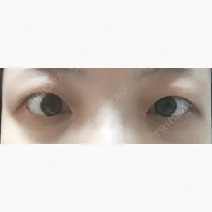 湘南美容クリニック 高松院口コミ