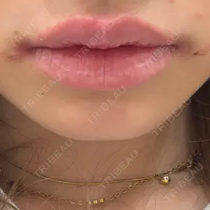 YBC横浜美容外科 立川院口コミ