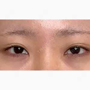 アリエル美容クリニック 水戸院口コミ