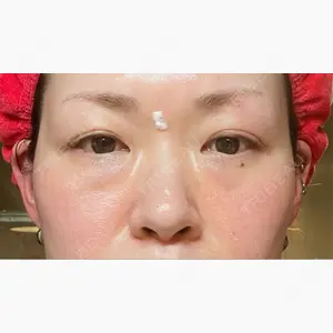 銀座みゆき通り美容外科 大阪梅田院口コミ