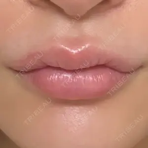 ルラ美容クリニック 名古屋栄院 / ルラスキンクリニック 名古屋栄院口コミ