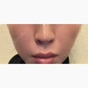 美容皮膚科ティファクリニック 新宿東口口コミ