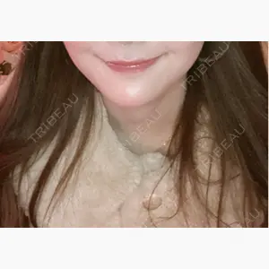 ハナビューティークリニック口コミ