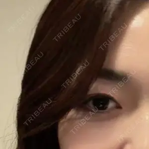 Natural Skin Clinic 笹塚院口コミ