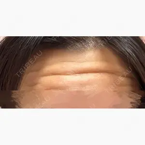 神戸スイミー皮膚科美容外科口コミ