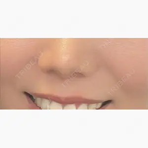 湘南美容クリニック 千葉センシティ院口コミ