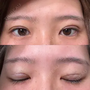 東京シンデレラ美容外科 大宮院口コミ