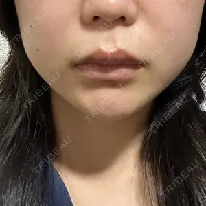 湘南美容クリニック 渋谷院口コミ