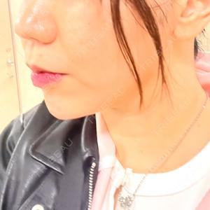 上野美容外科・美容皮膚科口コミ
