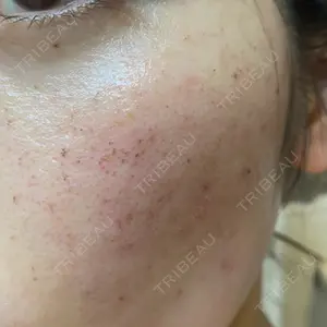 ルラ美容クリニック 宇都宮院口コミ