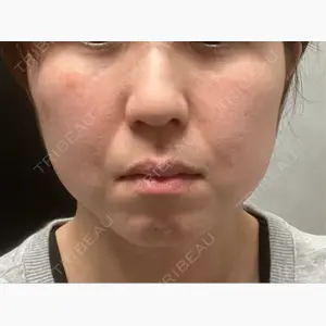 CROWN BEAUTY CLINIC口コミ