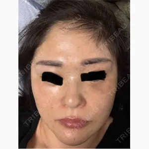 PRISM Beauty Clinic 新宿院口コミ