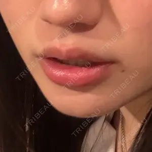 HAAB BEAUTY CLINIC 名古屋院口コミ
