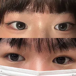小倉美容外科ネビュラクリニック口コミ