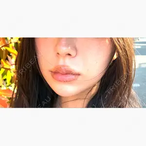 HAAB CLINIC 福岡院口コミ