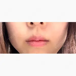 ルラ美容クリニック 福岡本院口コミ