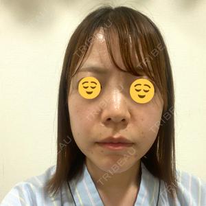 ザ・ホワイトデンタルクリニック 新宿院口コミ