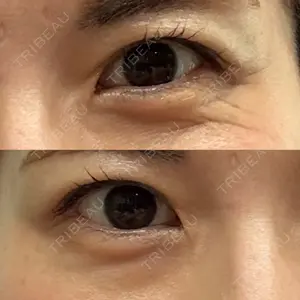TCB東京中央美容外科 福島院口コミ