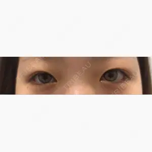 R Beauty CLINIC 名古屋院口コミ