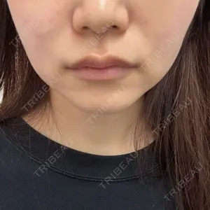 ルラ美容クリニック 大阪本院口コミ