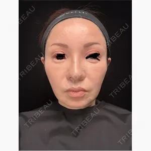Tokyo Tensei Clinic 新宿院口コミ