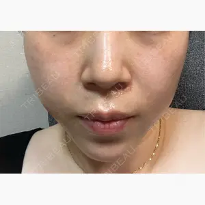 ルラ美容クリニック 町田院口コミ
