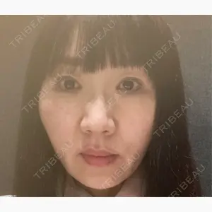 札幌美容外科ネビュラクリニック口コミ