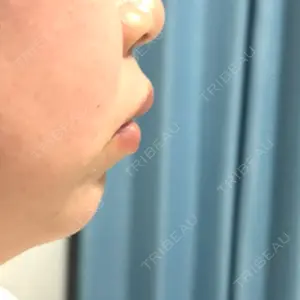 HAAB CLINIC 福岡院口コミ
