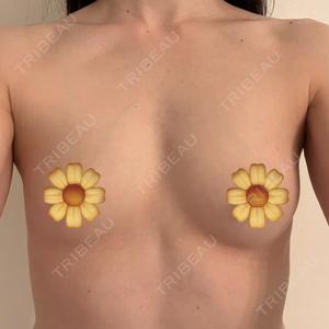 湘南美容クリニック 新橋銀座口院口コミ