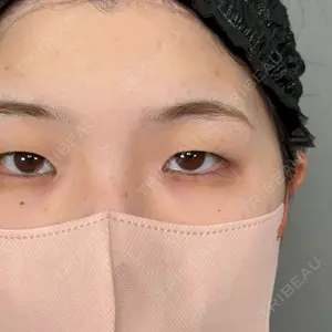 アリエル美容クリニック 大宮院口コミ