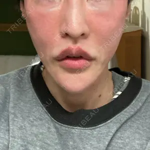 博多美容外科/美容皮膚科 ビラビューティークリニック口コミ