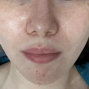 KARIS beauty clinic口コミ