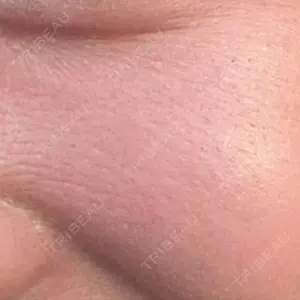 HAAB CLINIC 池袋院口コミ