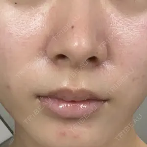 新宿Ladies&Gentlemen美容クリニック口コミ
