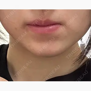 HAAB CLINIC 池袋院口コミ