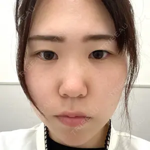 TCB東京中央美容外科 高崎院口コミ