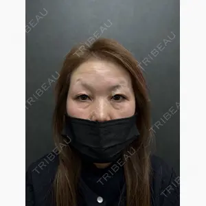 ネビュラクリニック 京都院口コミ