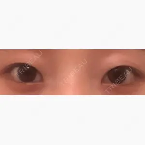 9BeautyClinic口コミ