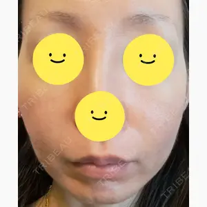 ゆきスキンクリニック 東池袋口コミ