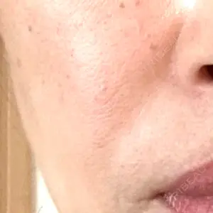 ゆきスキンクリニック 東池袋口コミ